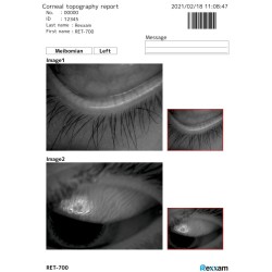 REXXAM - RET-700 Dry-Eye module with Infra-Red Meibomian analysis