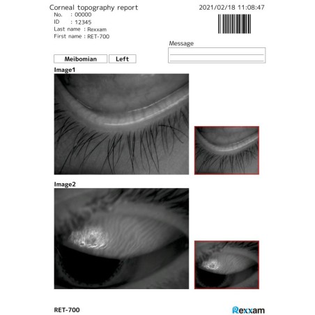 REXXAM - RET-700 Dry-Eye module with Infra-Red Meibomian analysis