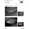 REXXAM - RET-700 Dry-Eye module with Infra-Red Meibomian analysis